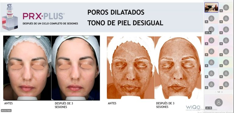 webinar wiqo imagen