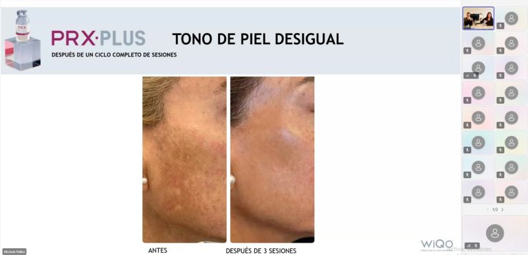 webinar wiqo imagen 2